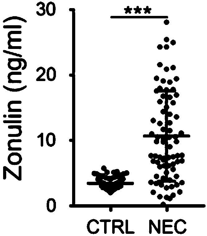 Peripheral blood inflammatory biomarker Zonulin for detecting necrotizing enterocolitis of newborn (NEC) and application thereof