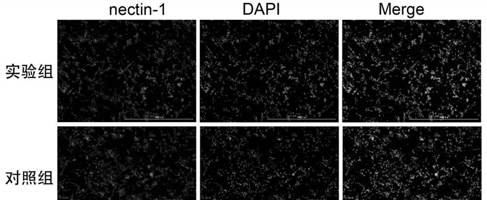 Virus receptor protein for diagnosing leucoderma and application thereof