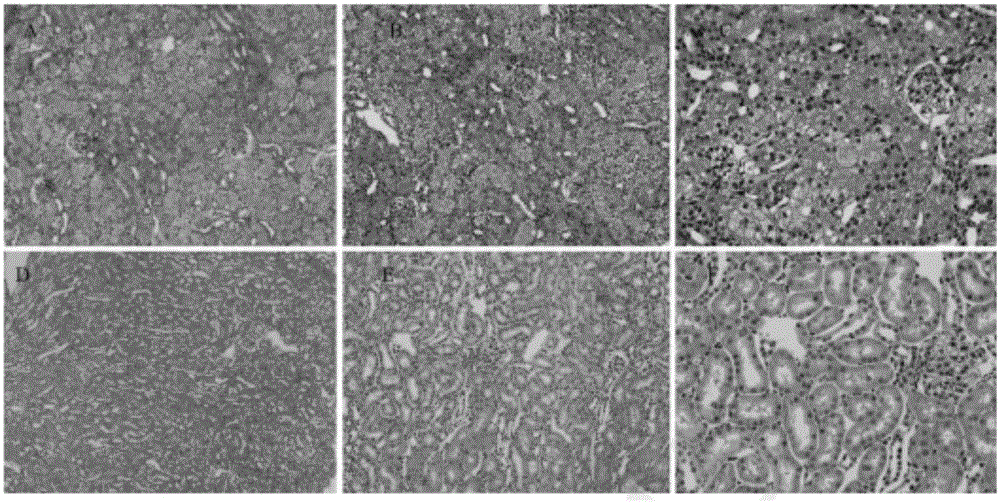 Construction method of contrast agent induced acute kidney injury animal model