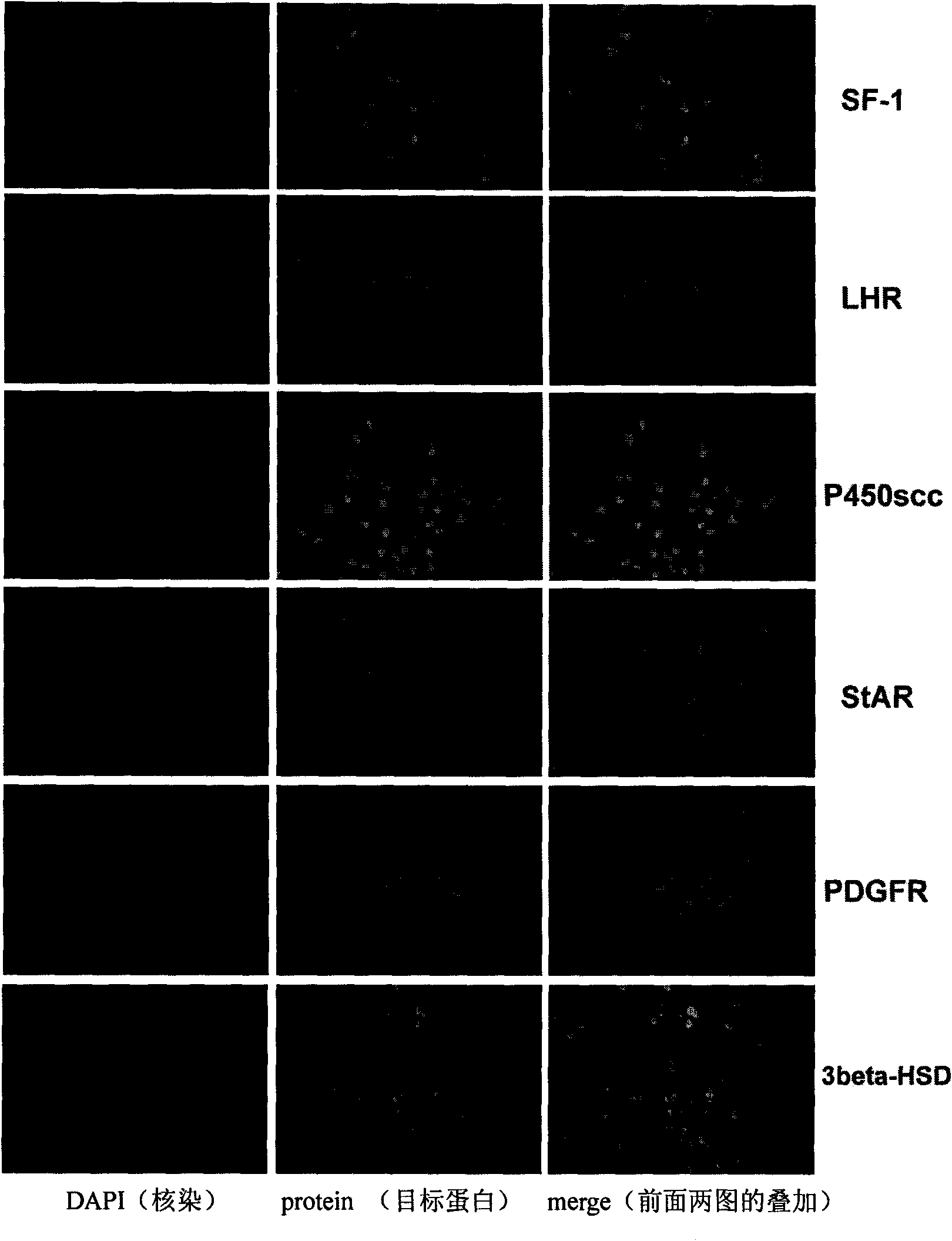 Construction and application of model for differentiating stem cells into testicular interstitial cells