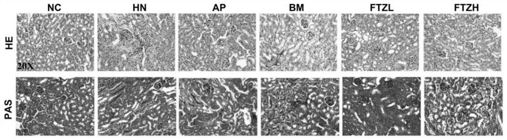 Novel application of compound fructus ligustri lucidi and rhizoma atractylodis lipid regulating capsule for treating hyperuricemia and gout kidney