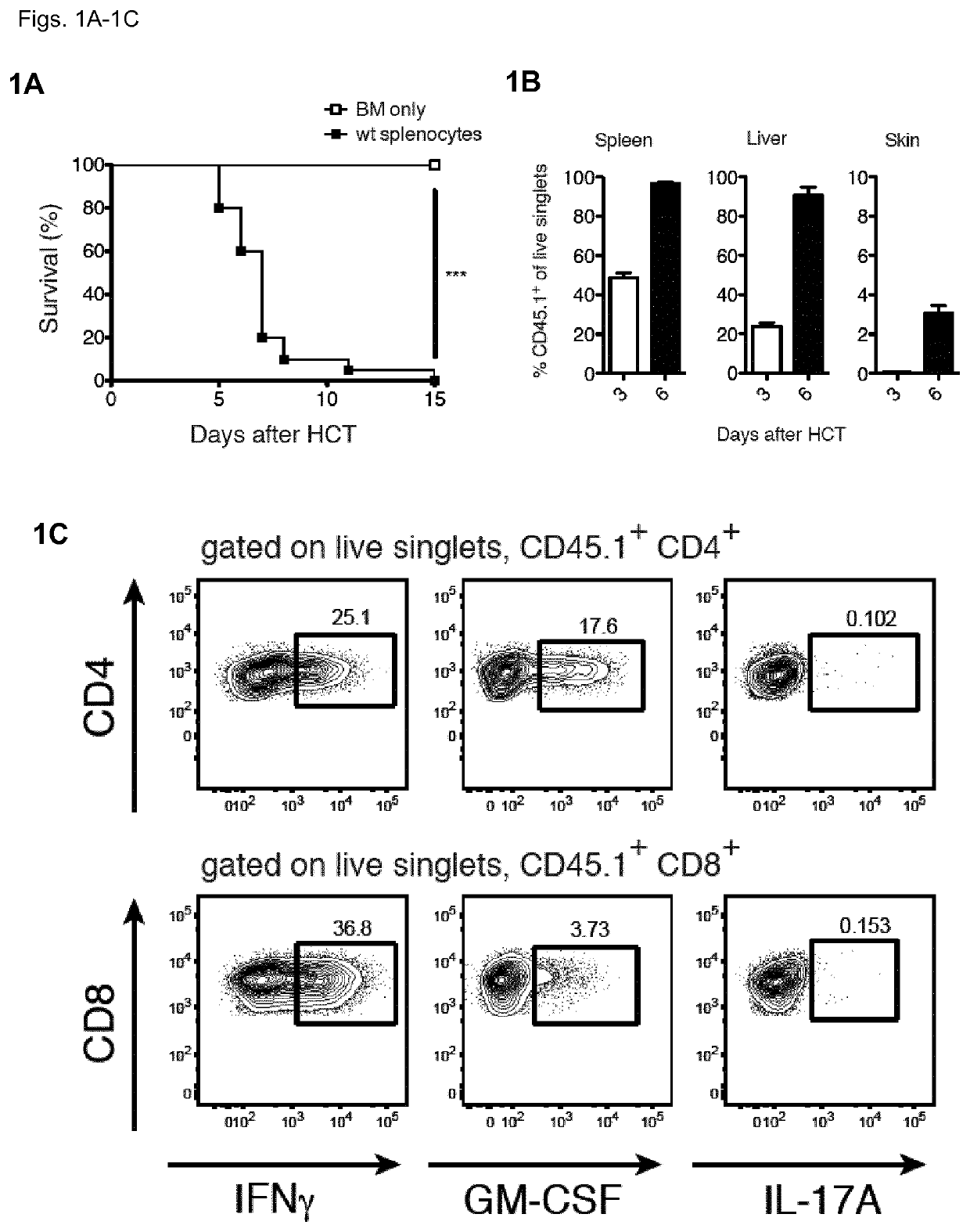 Ligands to gm-csf or gm-csf-receptor for use in treatment of a haematologic malignancy in a patient having undergone allo-hct