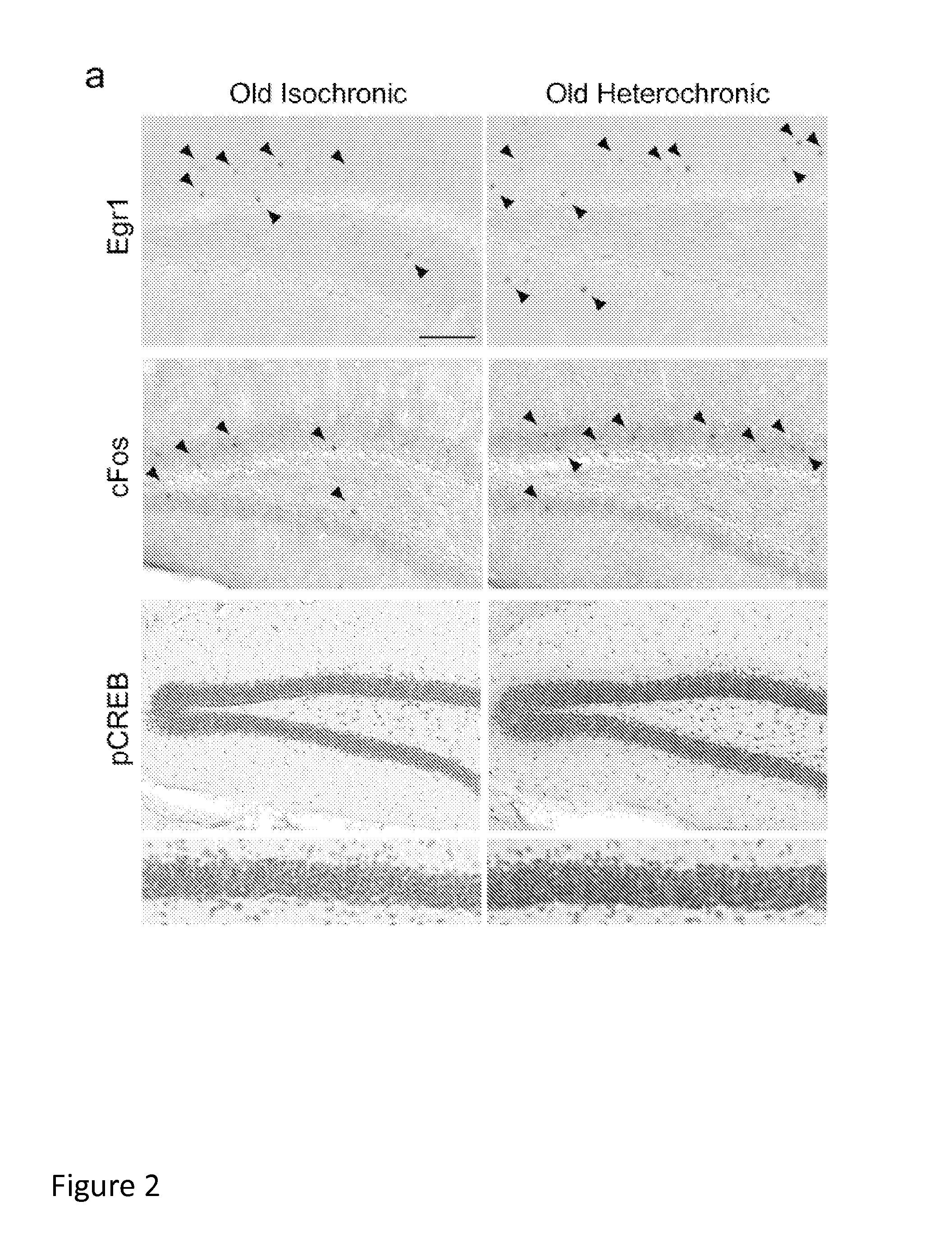 Methods and compositions for treating aging-associated conditions