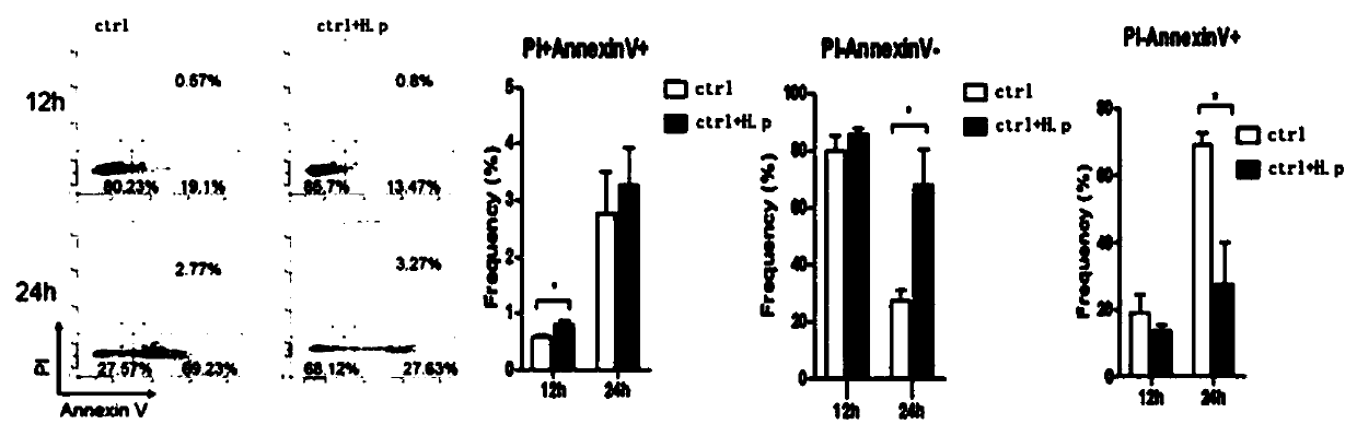 Application of Silvestrol in preparation of medicine for treating upper gastrointestinal diseases caused by helicobacter pylori infection