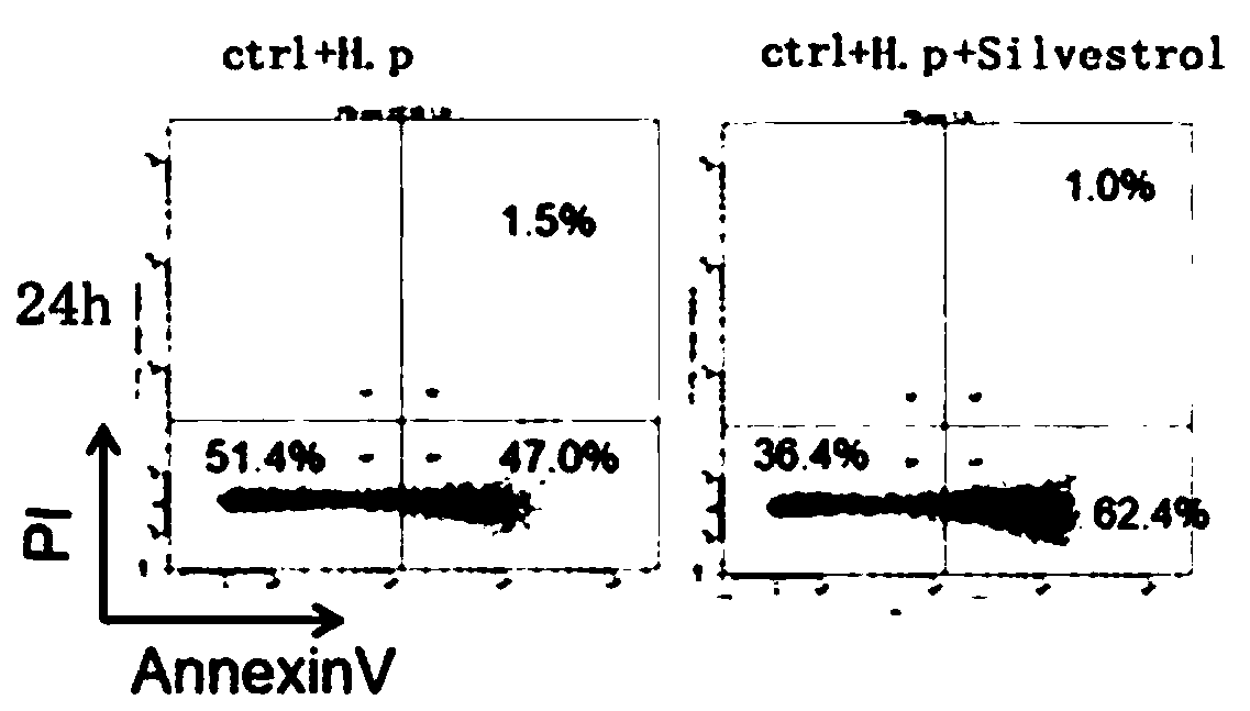 Application of Silvestrol in preparation of medicine for treating upper gastrointestinal diseases caused by helicobacter pylori infection