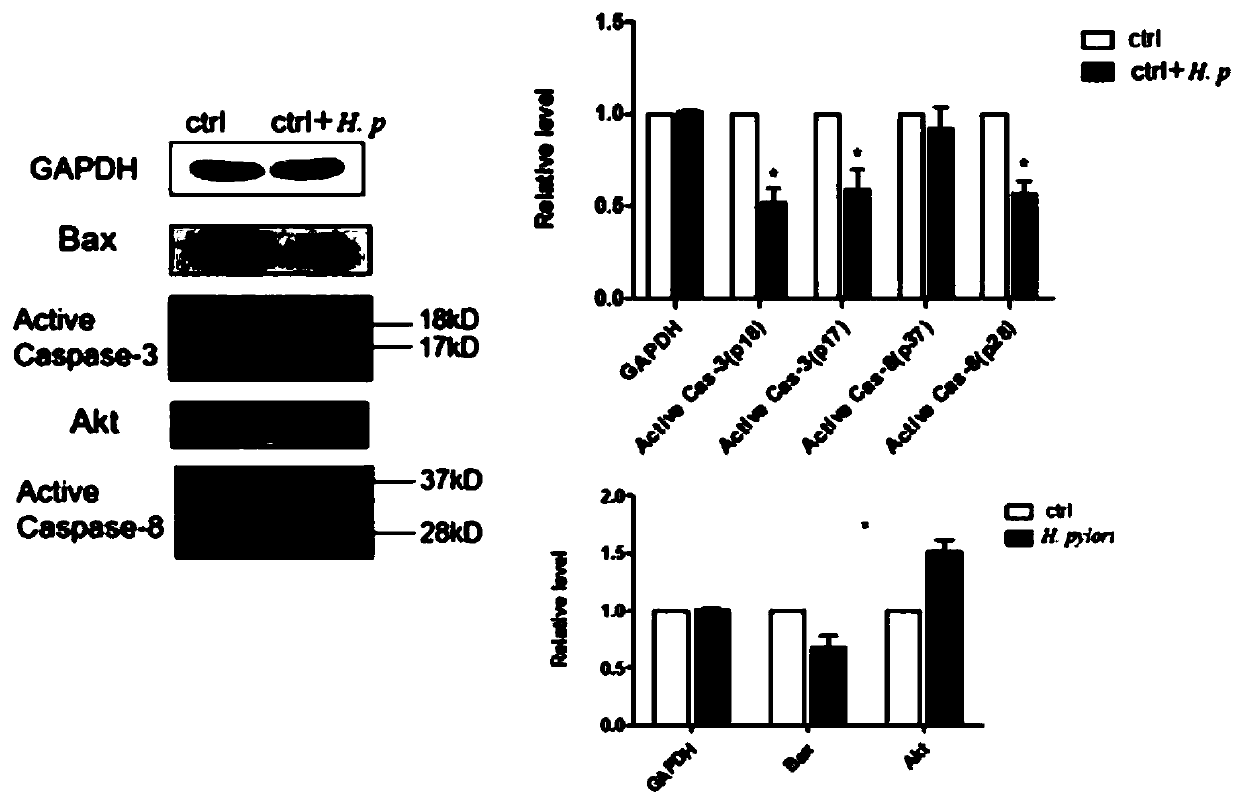 Application of Silvestrol in preparation of medicine for treating upper gastrointestinal diseases caused by helicobacter pylori infection