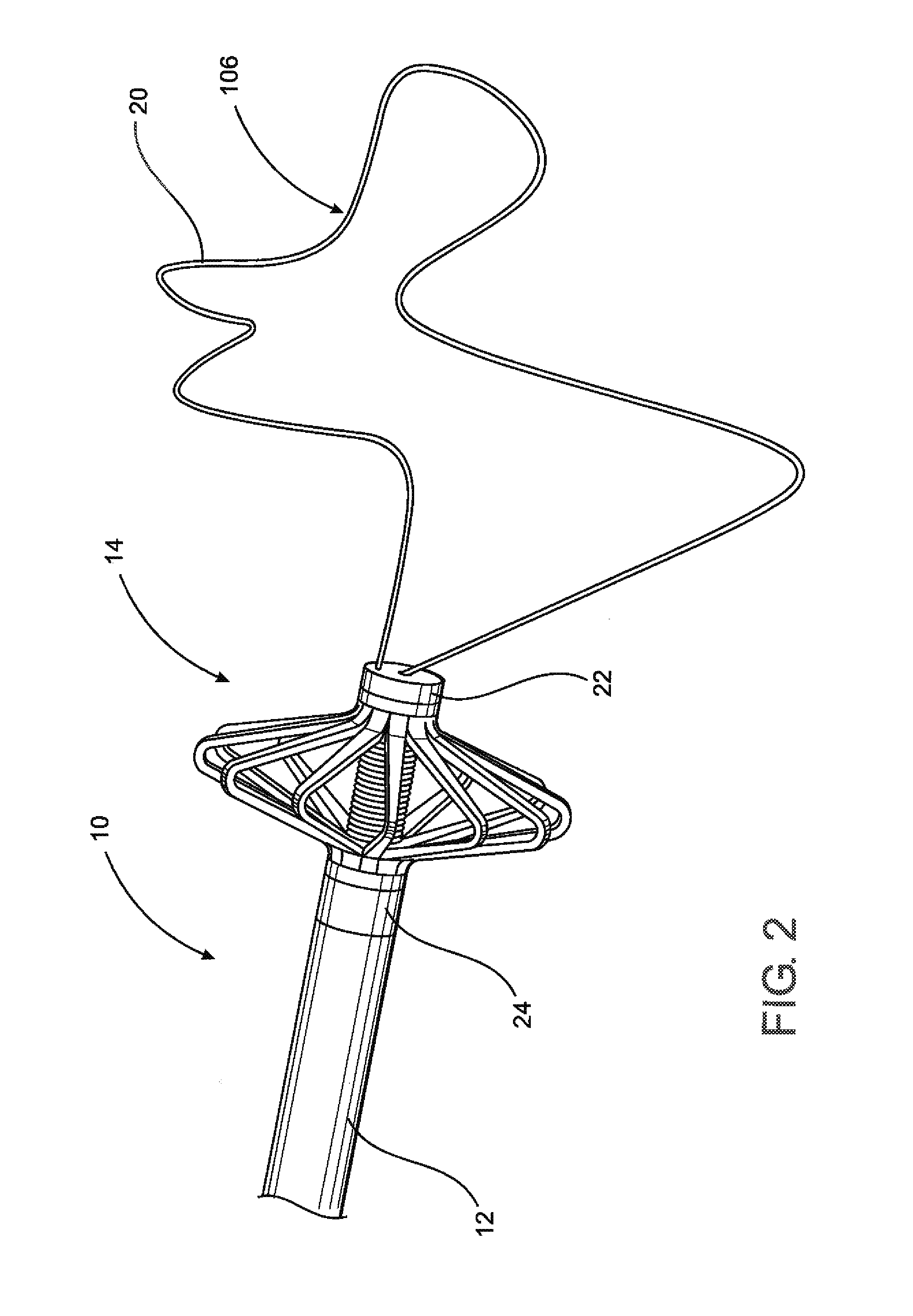 Assembly and method for left atrial appendage occlusion