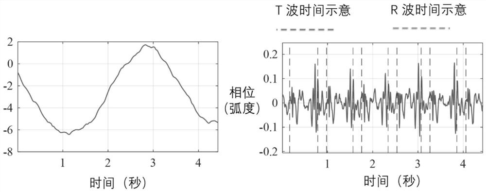 Non-contact electrocardiogram monitoring method based on millimeter wave radar