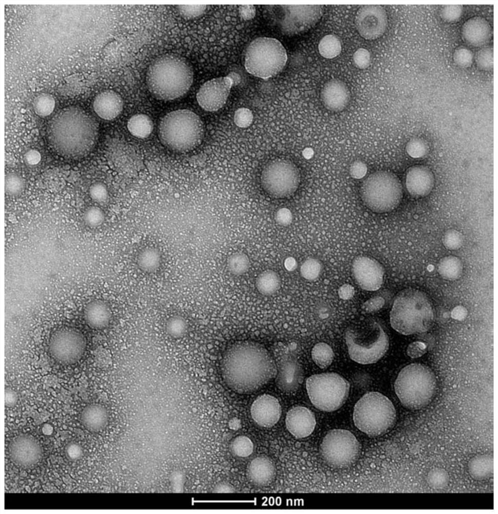 Polymer vesicle, preparation method thereof and drug-loaded vesicle