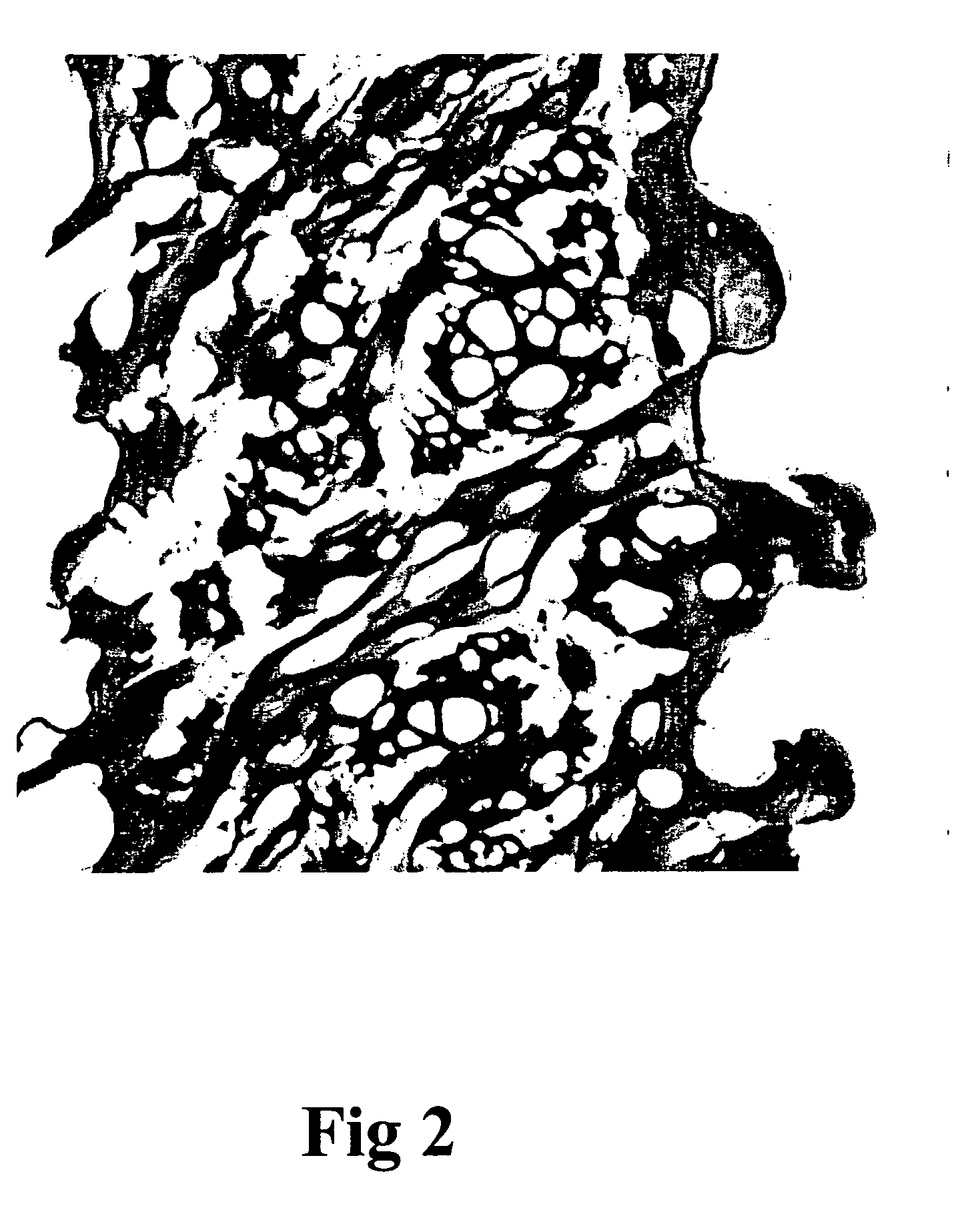 Process for preparing porous collagen matrix from connective tissue