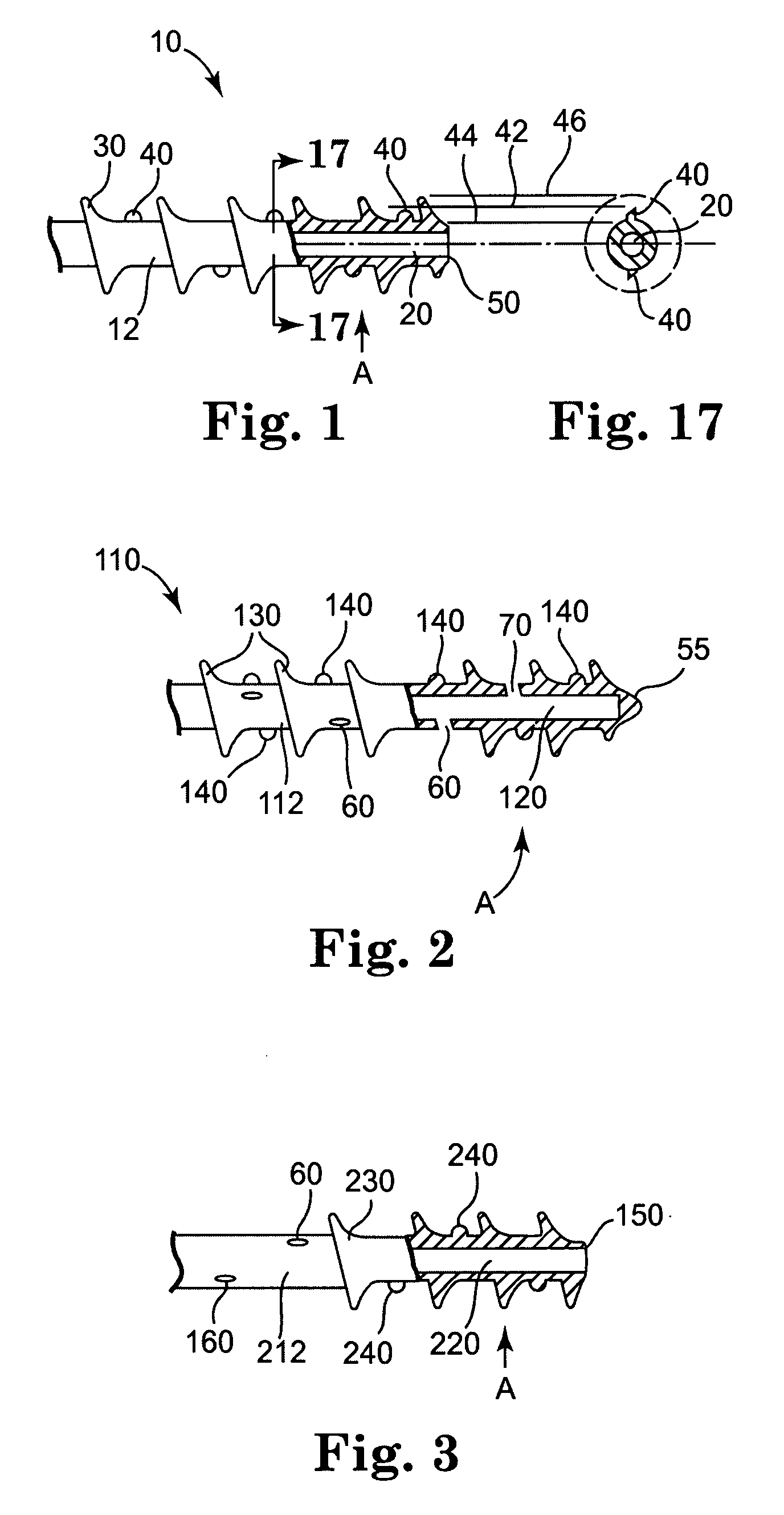 Bone screw with fluid delivery structure