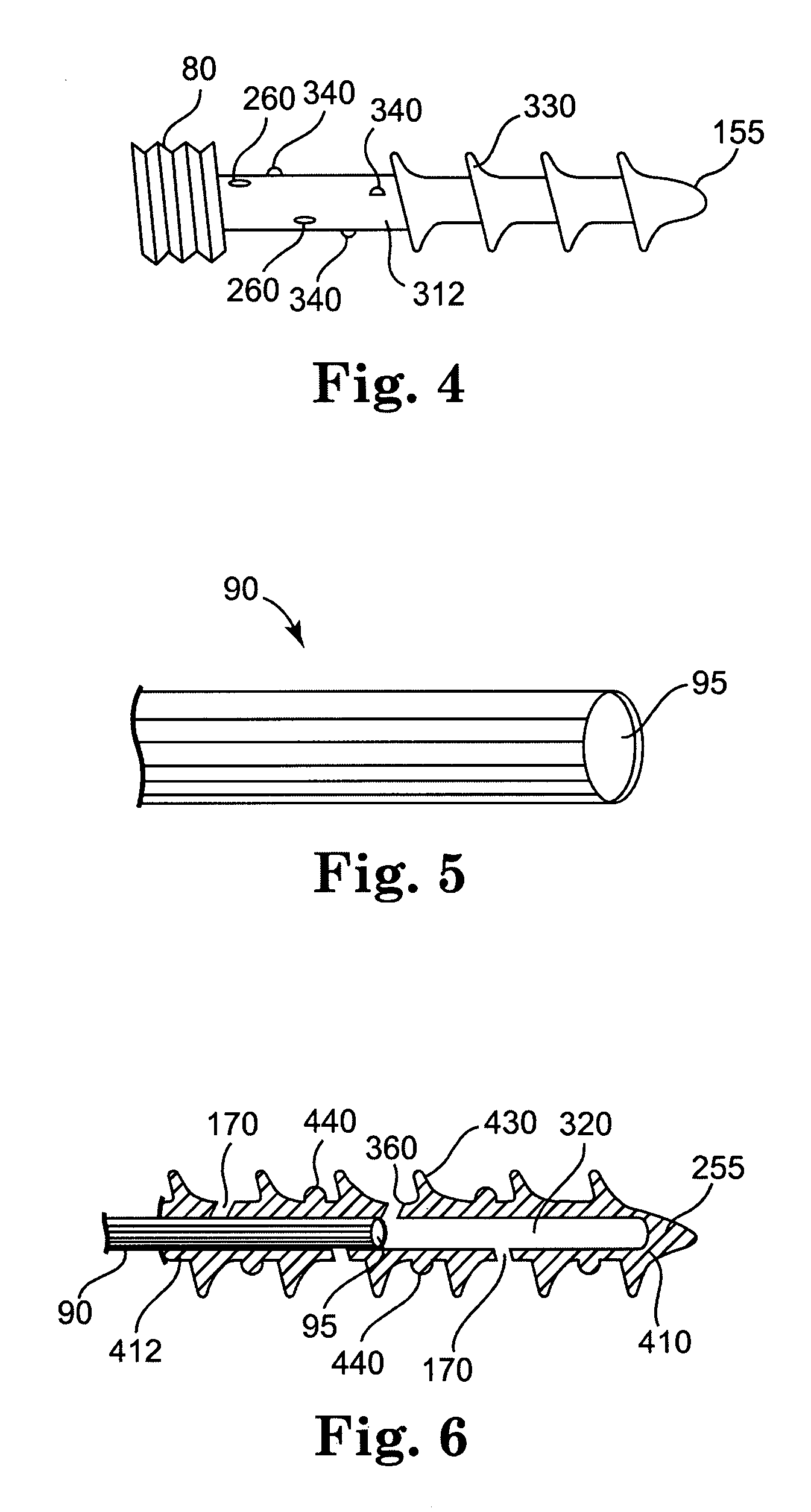 Bone screw with fluid delivery structure