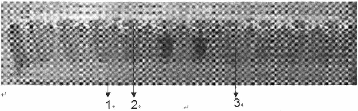 Kit for separating genome DNA by using magnetic balls and application thereof