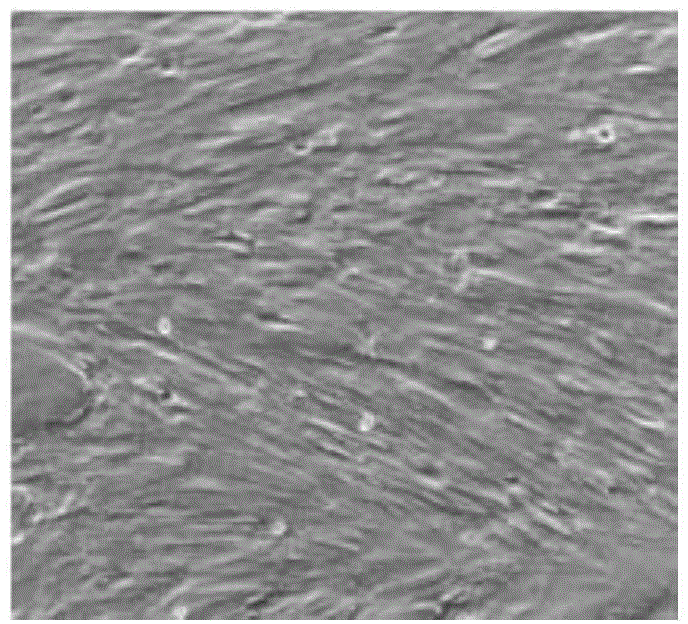 Construction method for human hair follicle stem cell bank