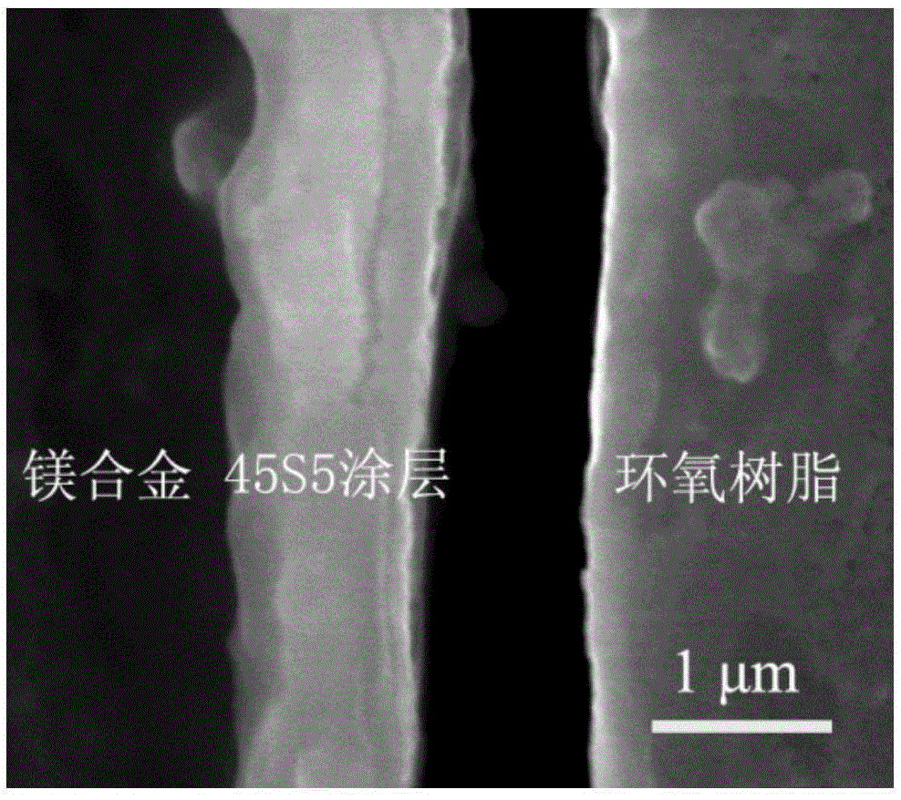 Method for preparing bioactive glass coating-coated magnesium alloy medical material by pressurized heat treatment