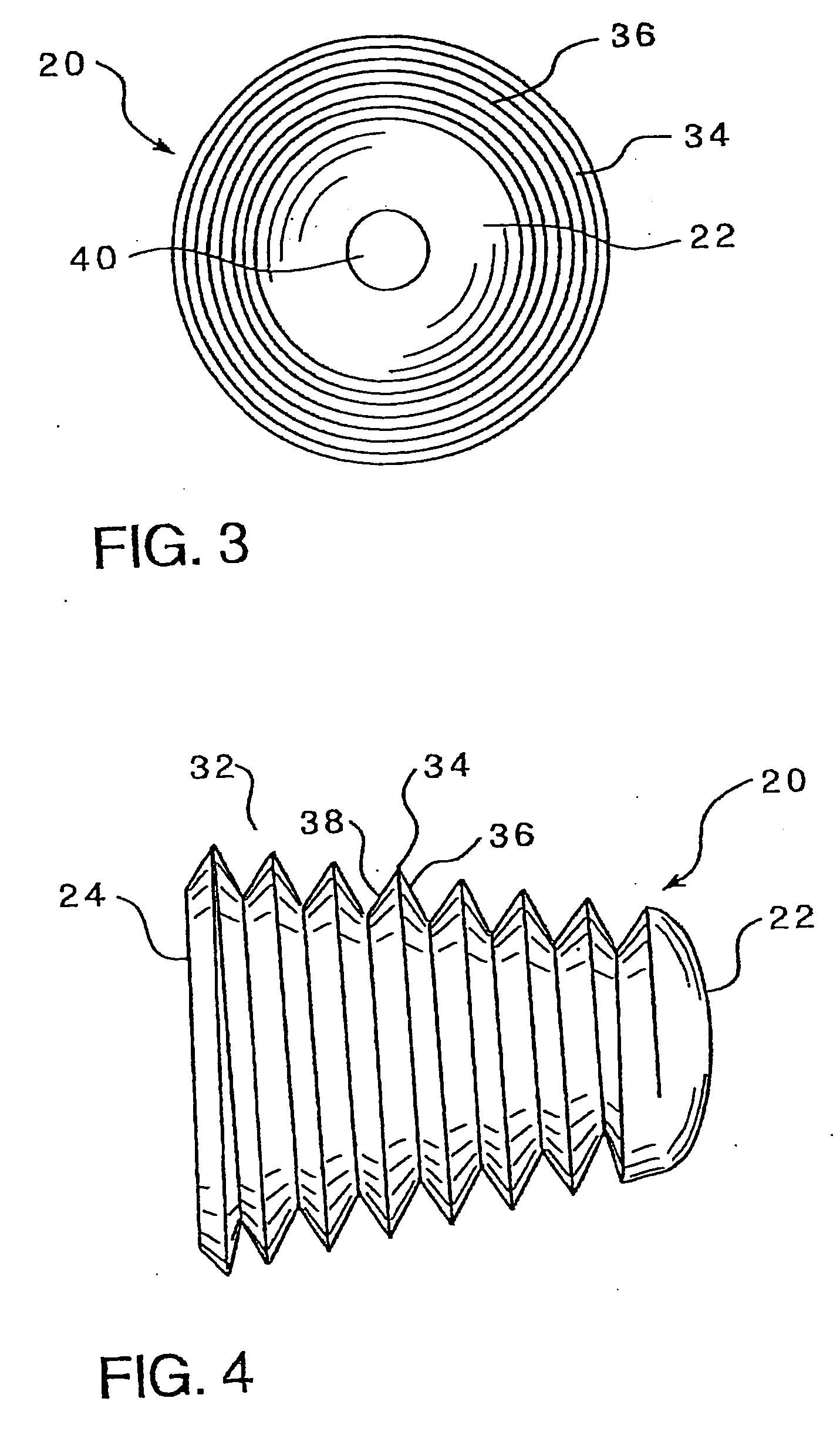 Subtalar implant and methods of use thereof