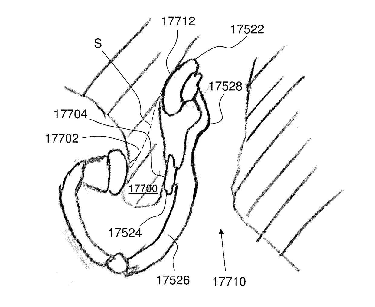 Transcutaneous electrostimulator and methods for electric stimulation