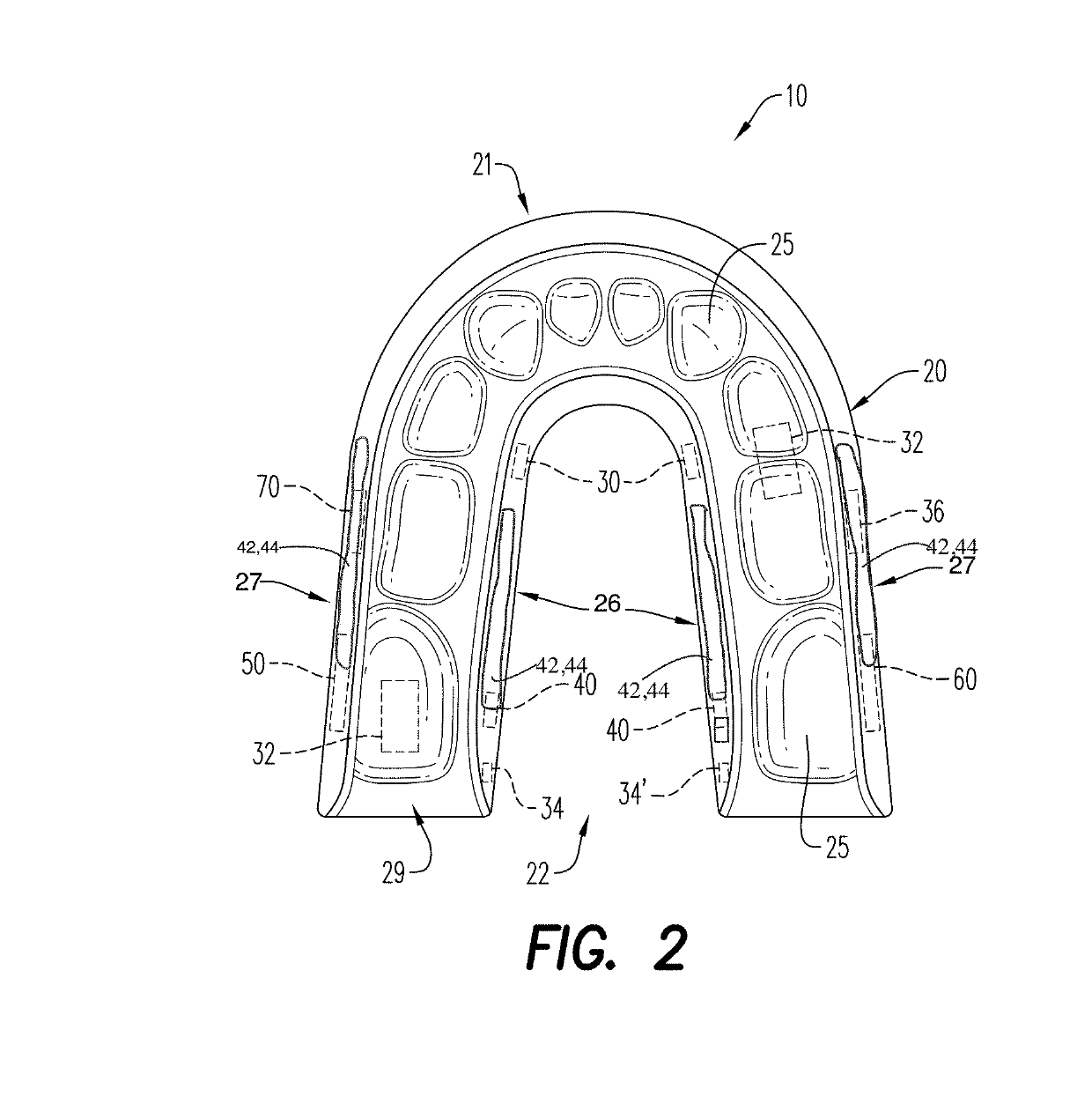 Removable mandibular pharmaceutical delivery device