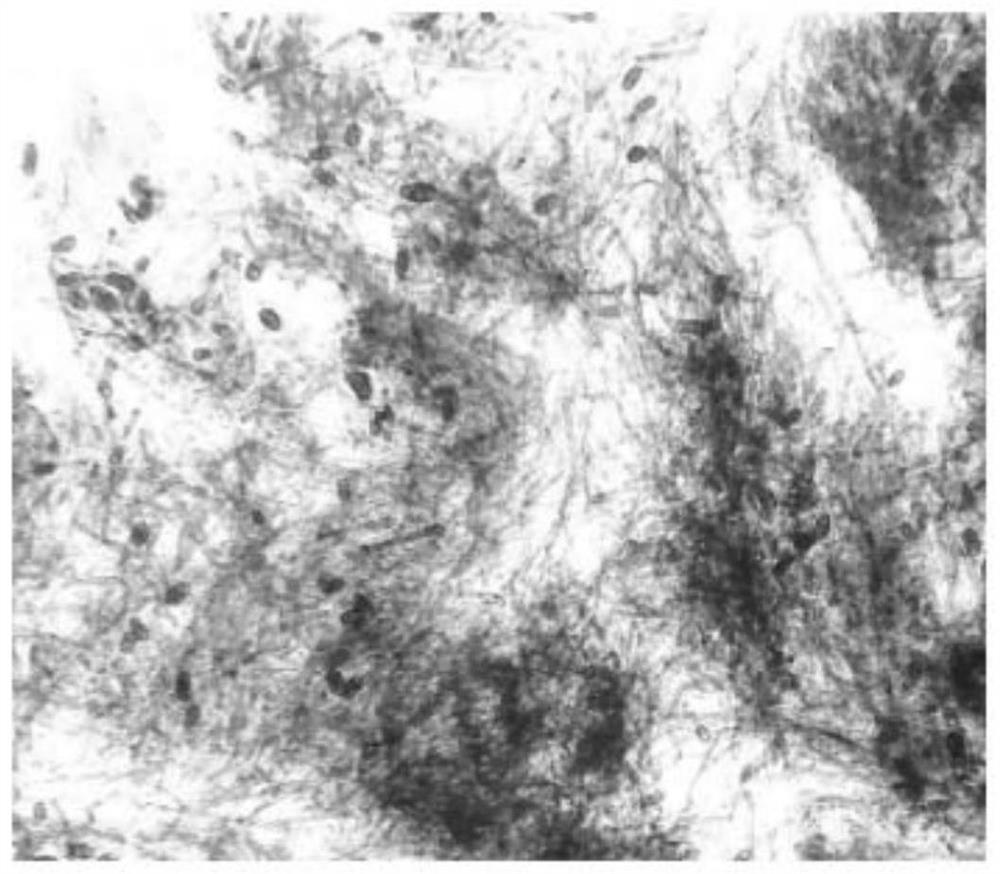 A method for the stable germination of conidia of tomato gray leaf spot and its use for artificial inoculation identification at the seedling stage