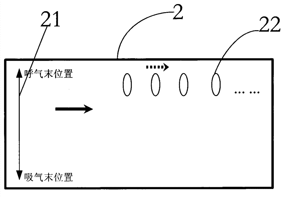 Magnetic resonance imaging collecting system and magnetic resonance imaging collecting method