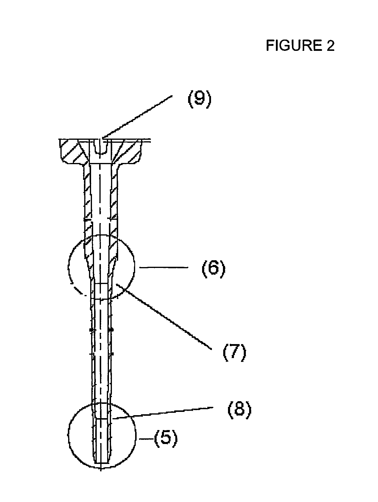 Injection moulding of a catheter