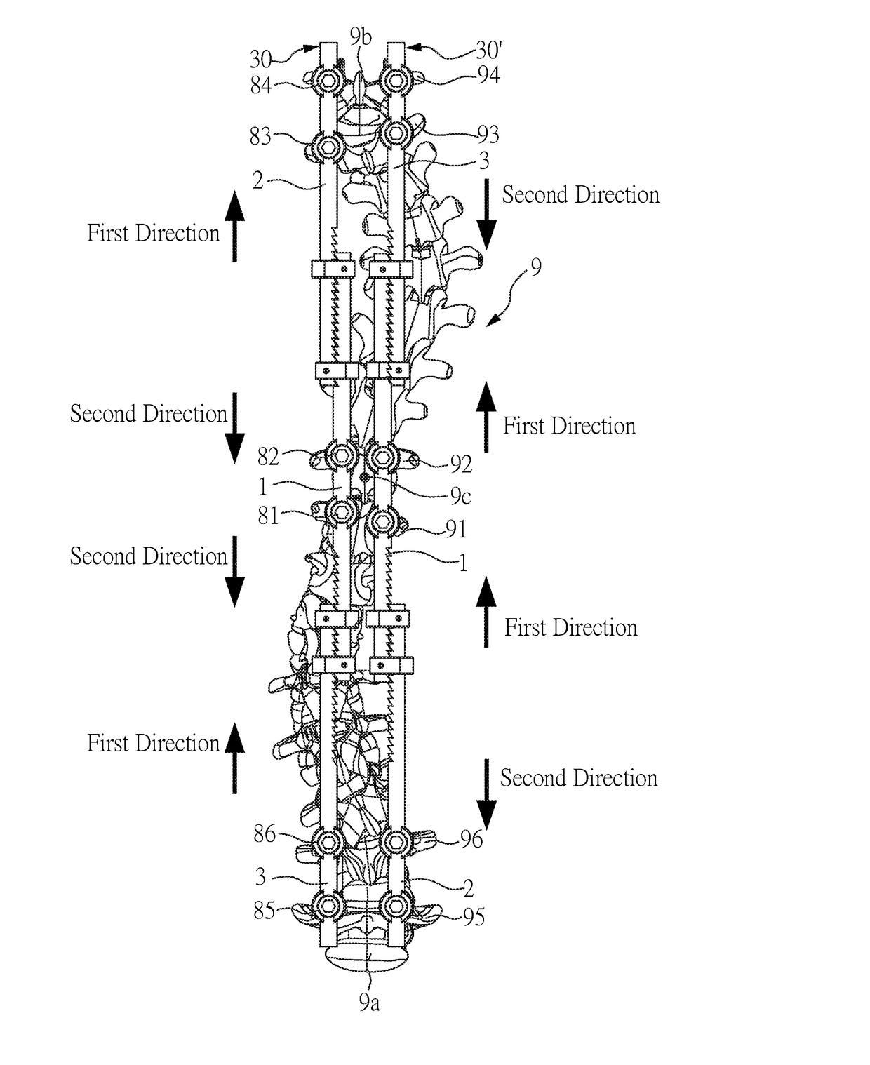 Spine correction apparatus