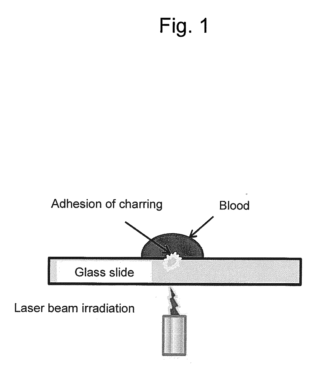 System for preventing blood charring at laser beam emitting site of laser catheter