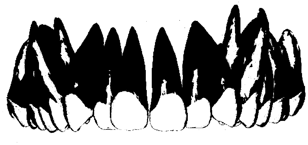 A method of reconstructing a patient's tooth root