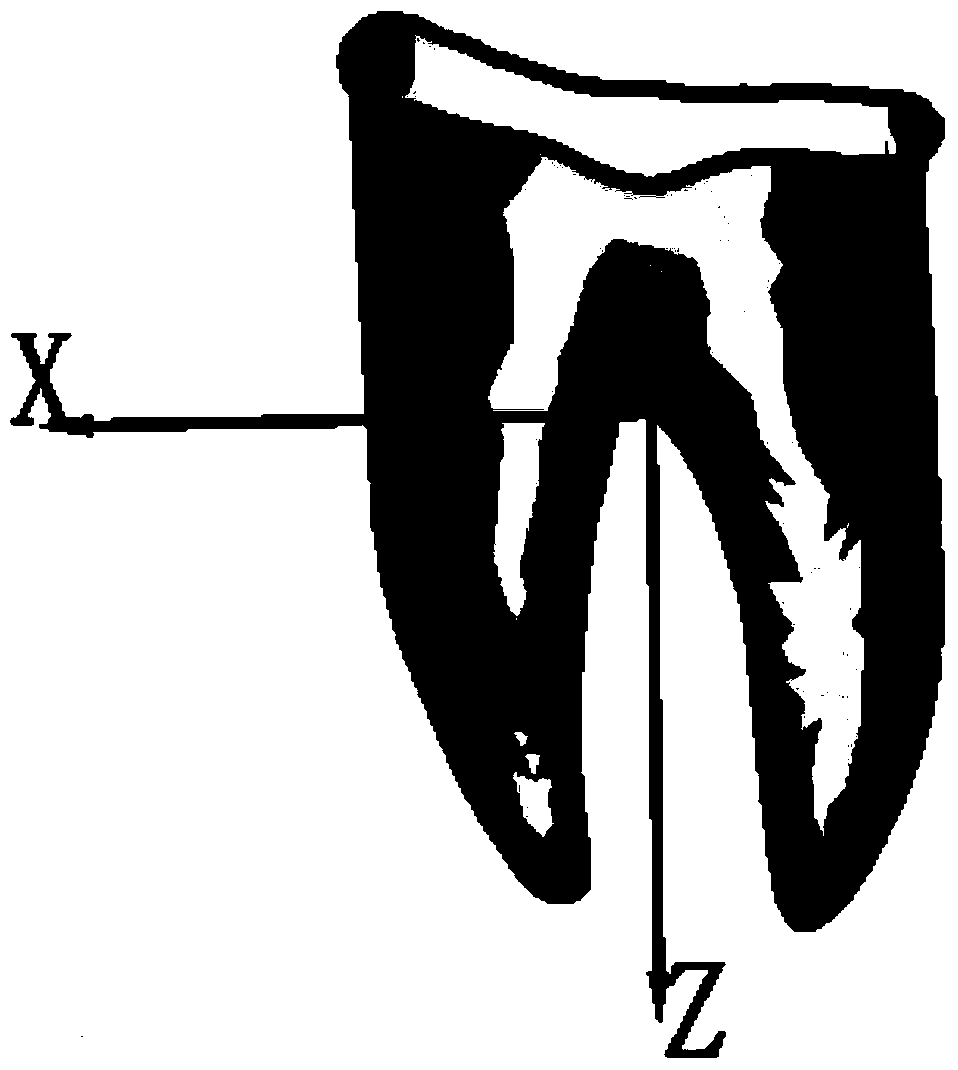 A method of reconstructing a patient's tooth root