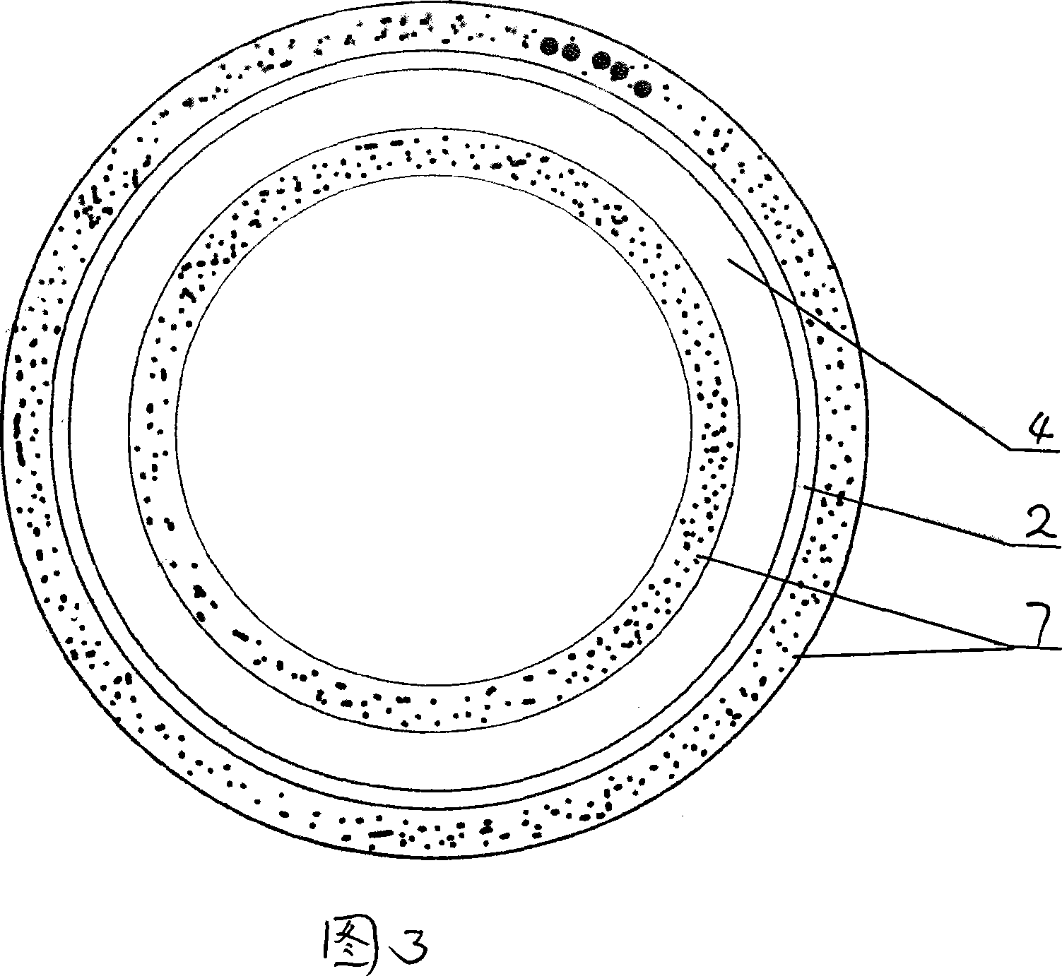 Blood vessel medicine support