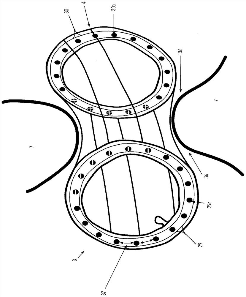 Gastrointestinal implant and positioning device for same