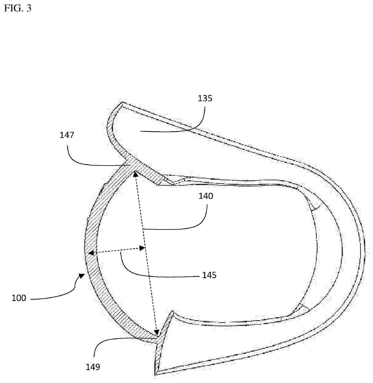 Device and method for opening an airway