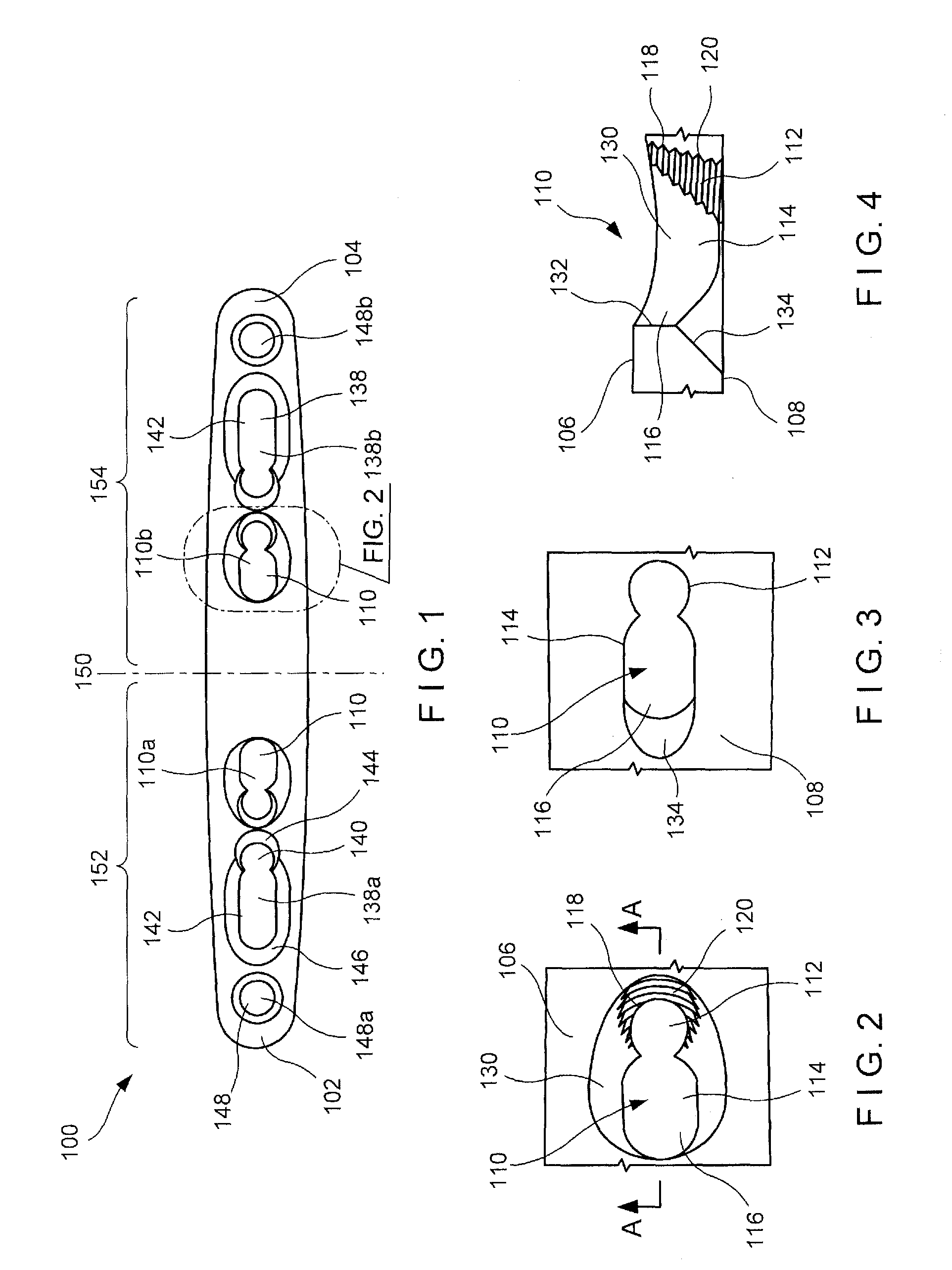 Ulna osteotomy system