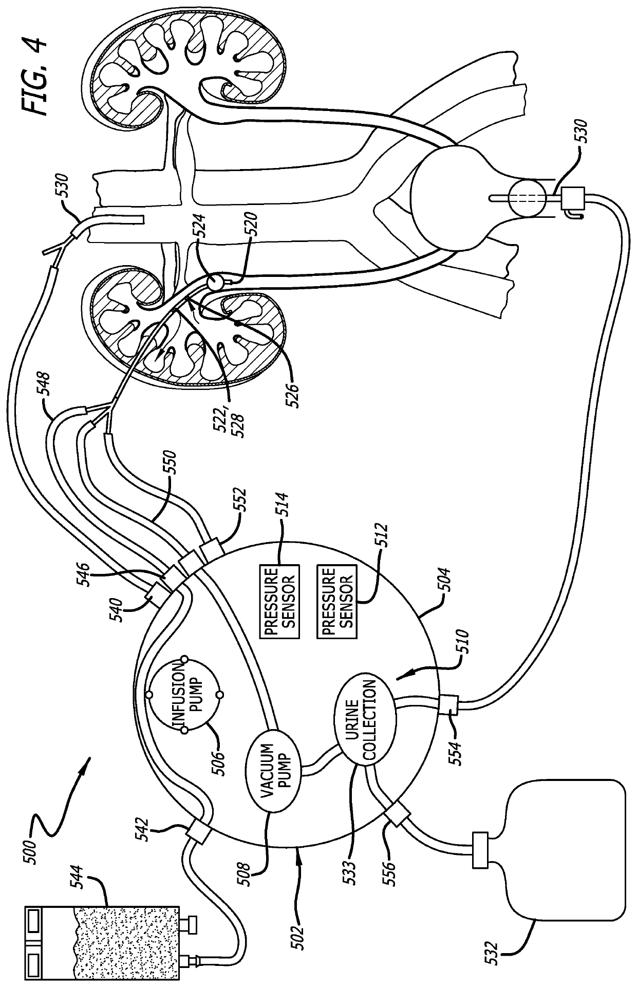 Urine Collecting System Interventions For Improving Kidney Function