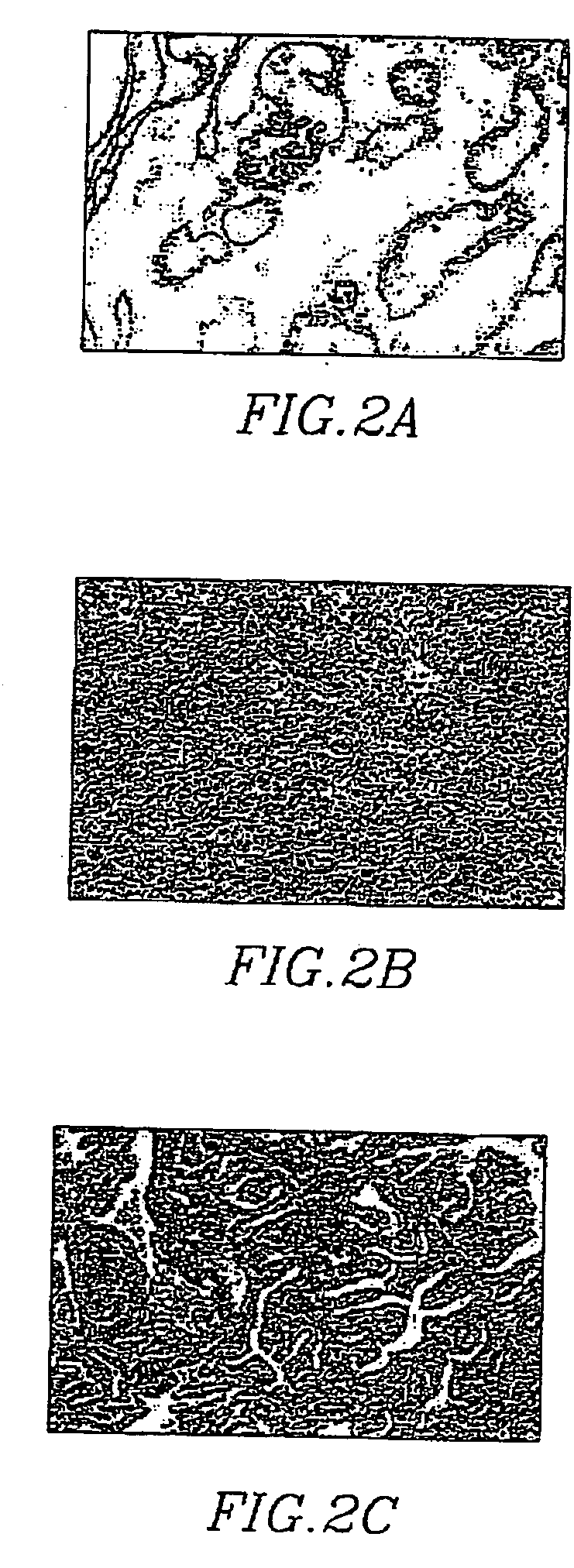 Method for treatment and chemoprevention of prostate cancer