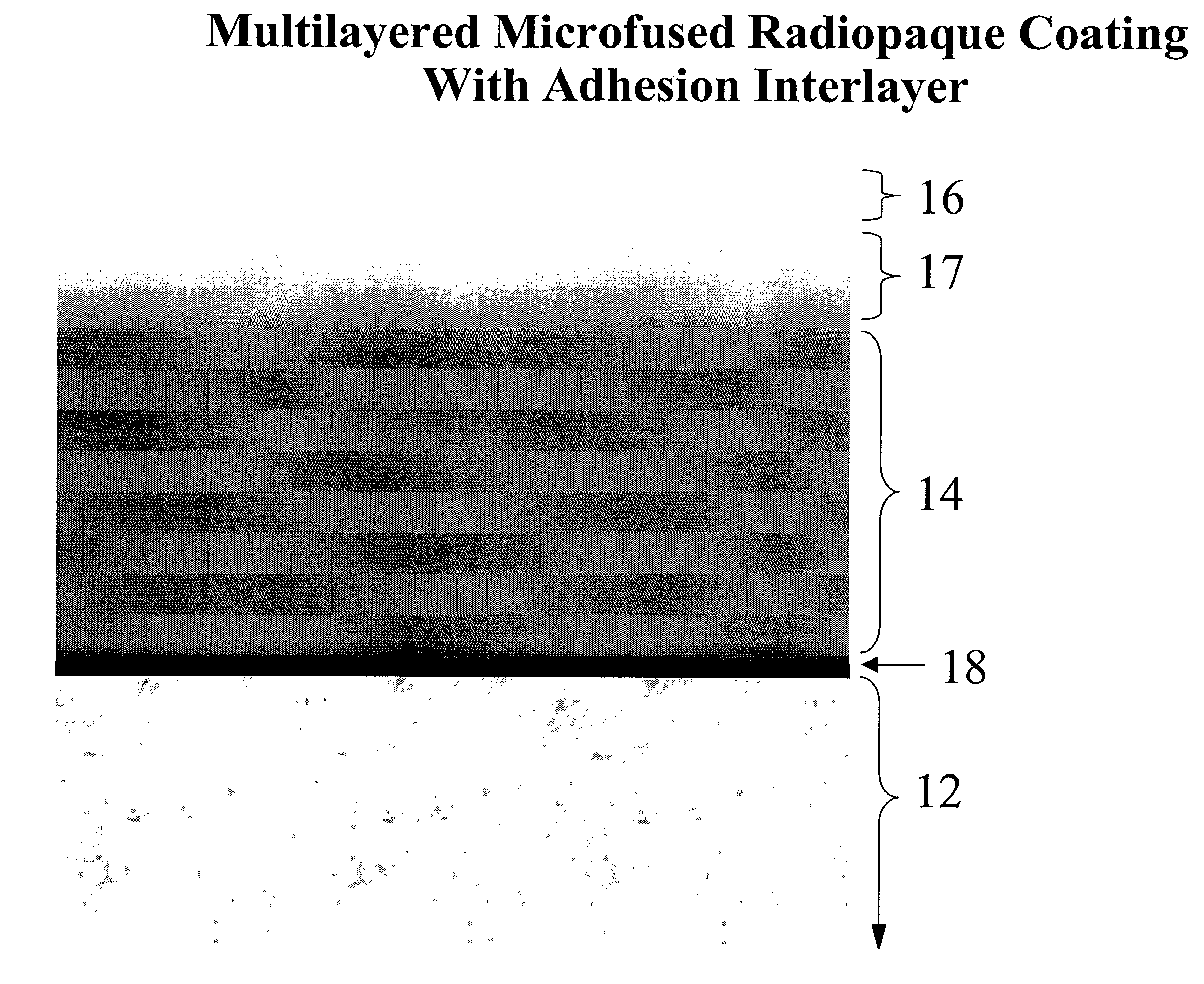 Multi-layered radiopaque coating on intravascular devices