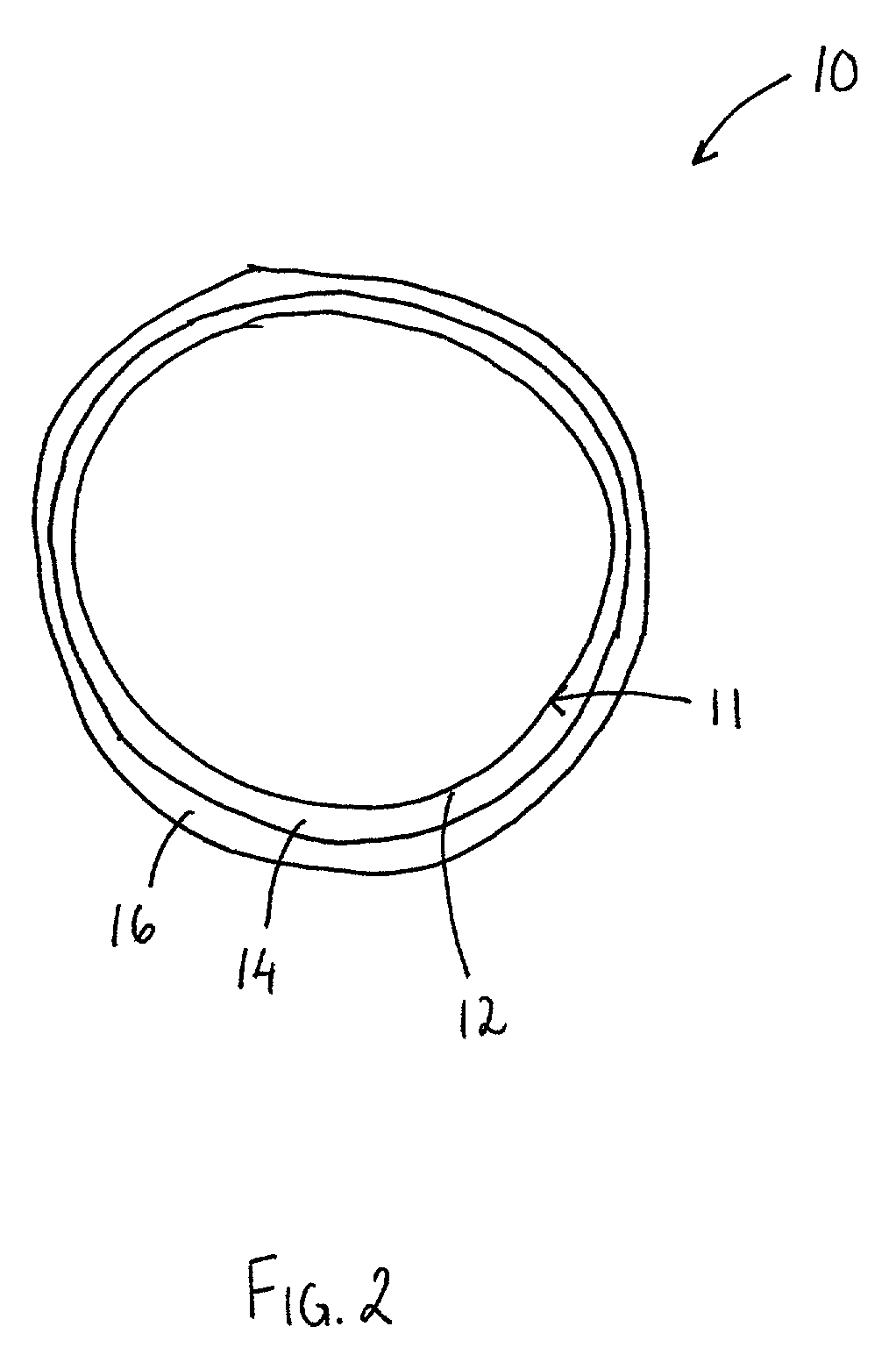 Multi-layered radiopaque coating on intravascular devices