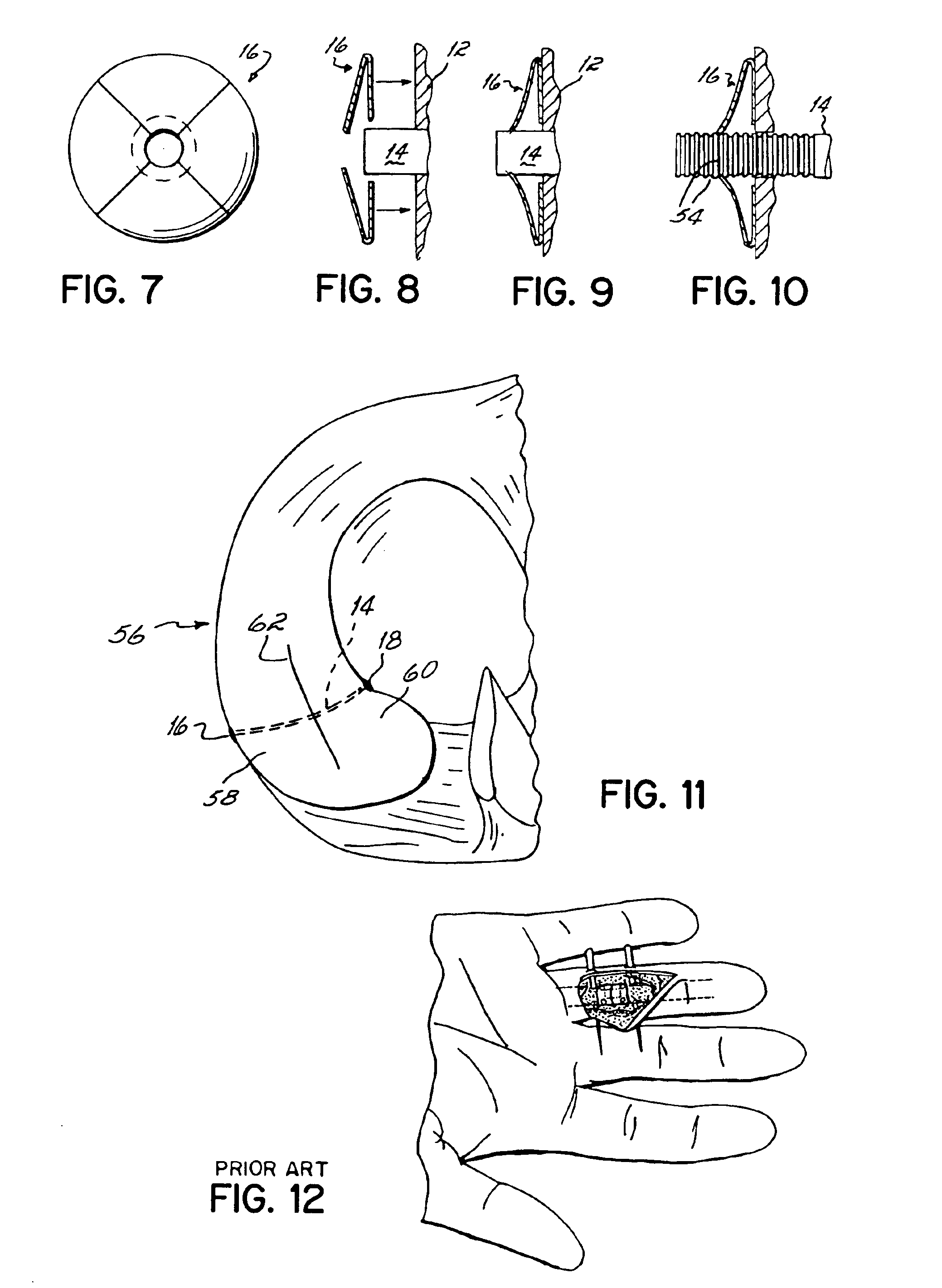 Apparatus and methods for tendon or ligament repair