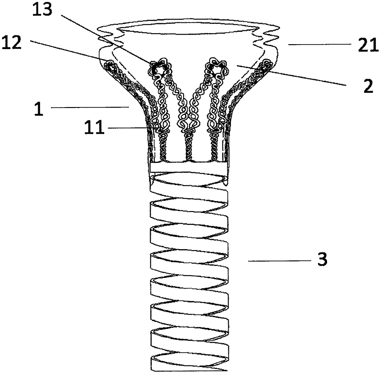 Device for auxiliary fixing