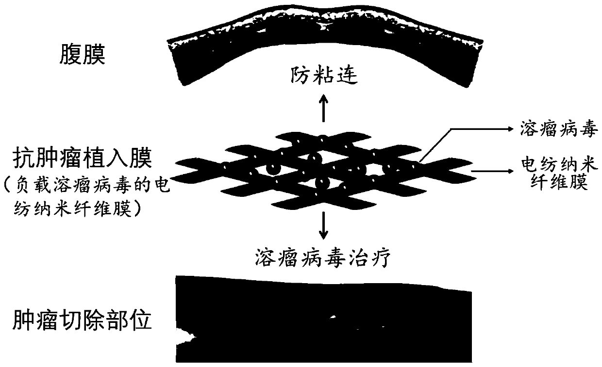 A kind of anti-tumor implant film and preparation method thereof