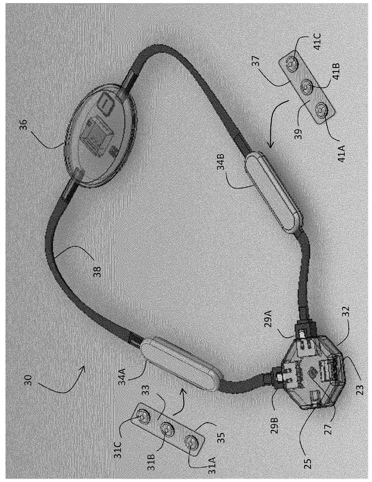 Body-worn sensor for characterizing patients with heart failure