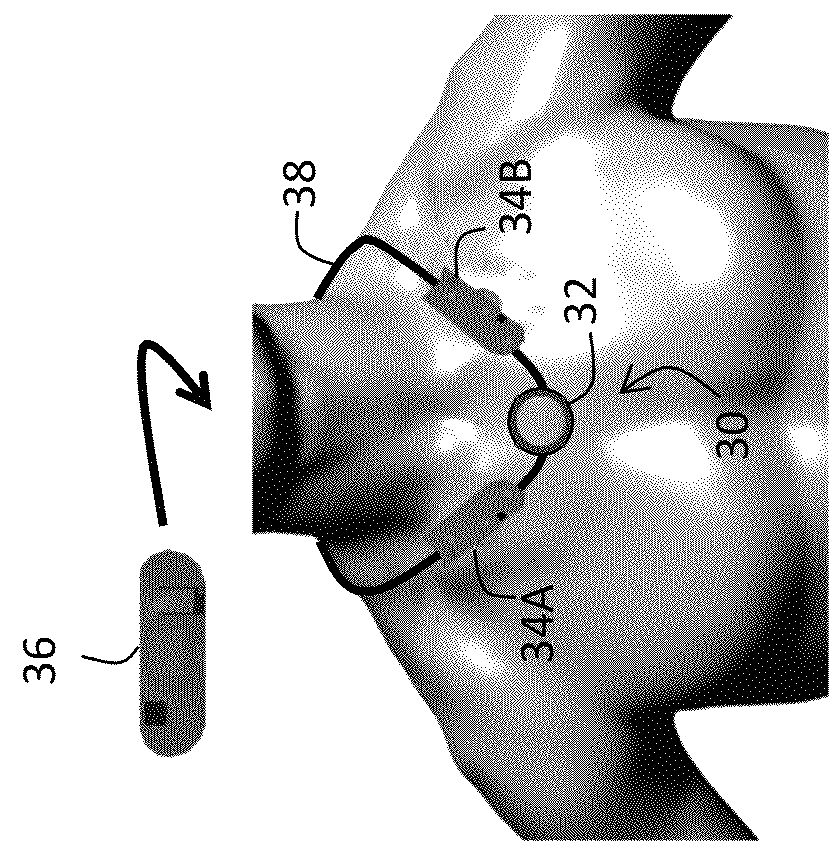 Body-worn sensor for characterizing patients with heart failure