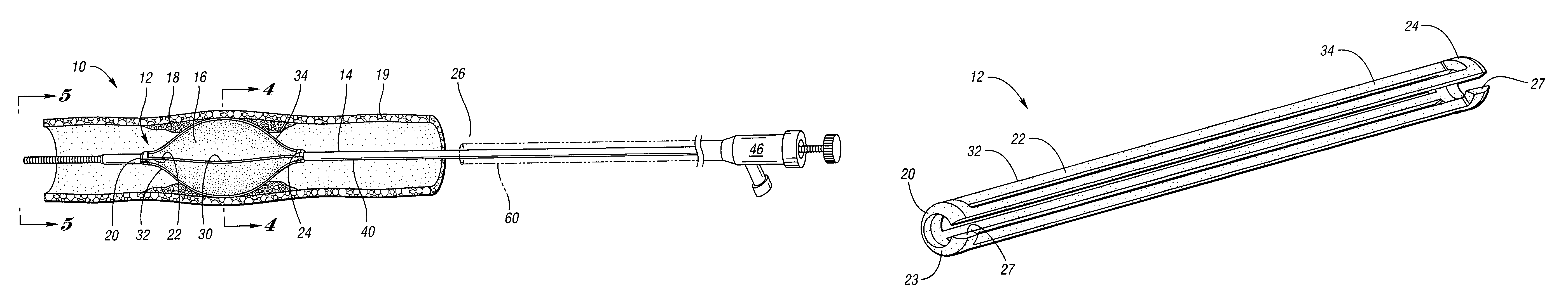 Angioplasty cutting device and method for treating a stenotic lesion in a body vessel