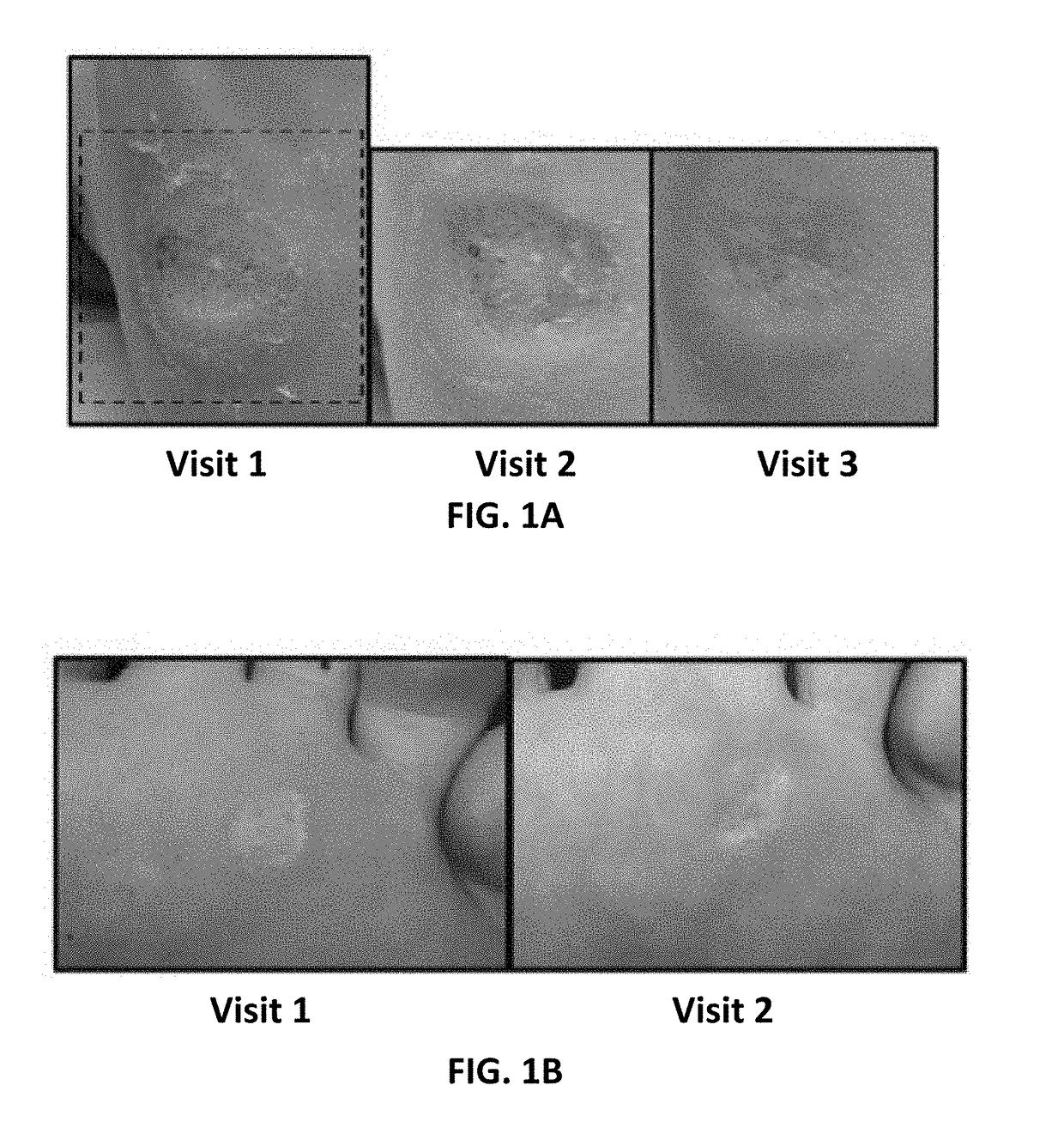 Method and apparatus for the treatment, management and/or control of pain