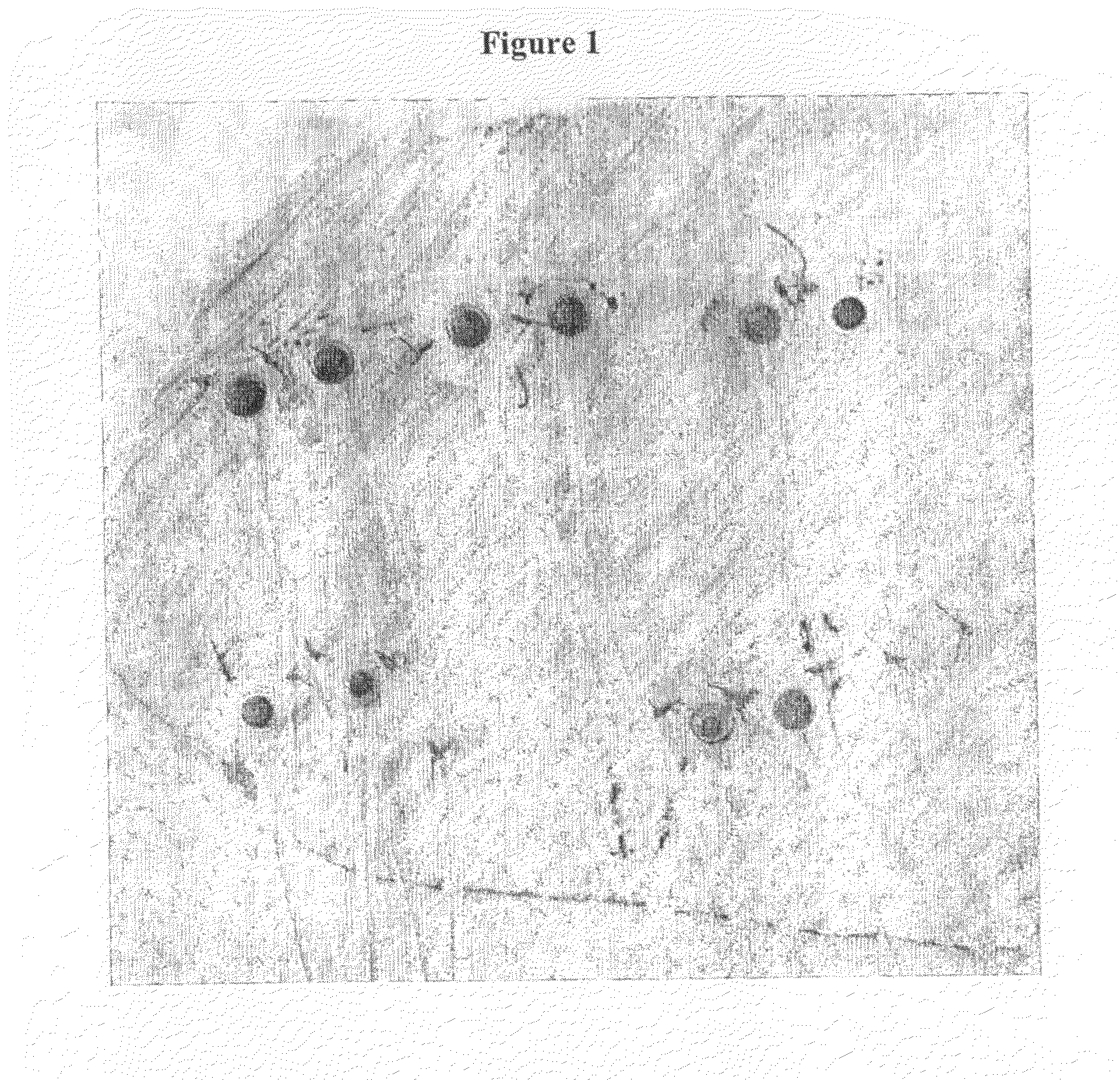 Methods for optimization of biventricular pacing devices and systems useful therefor