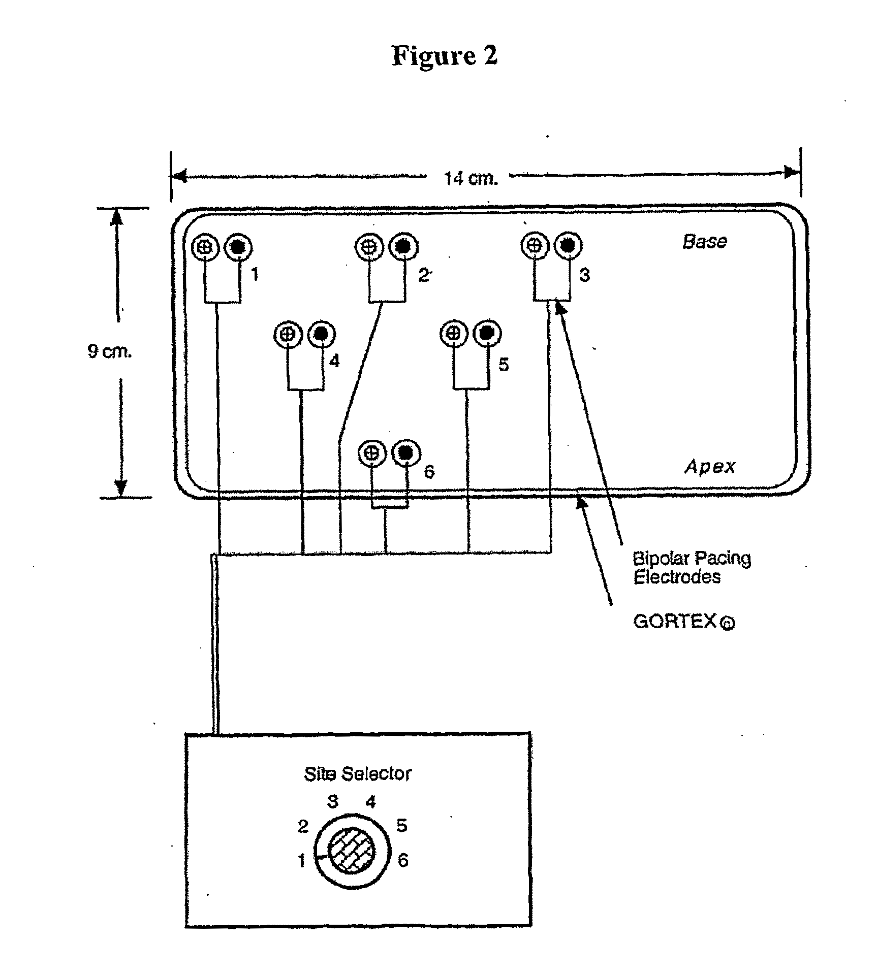 Methods for optimization of biventricular pacing devices and systems useful therefor