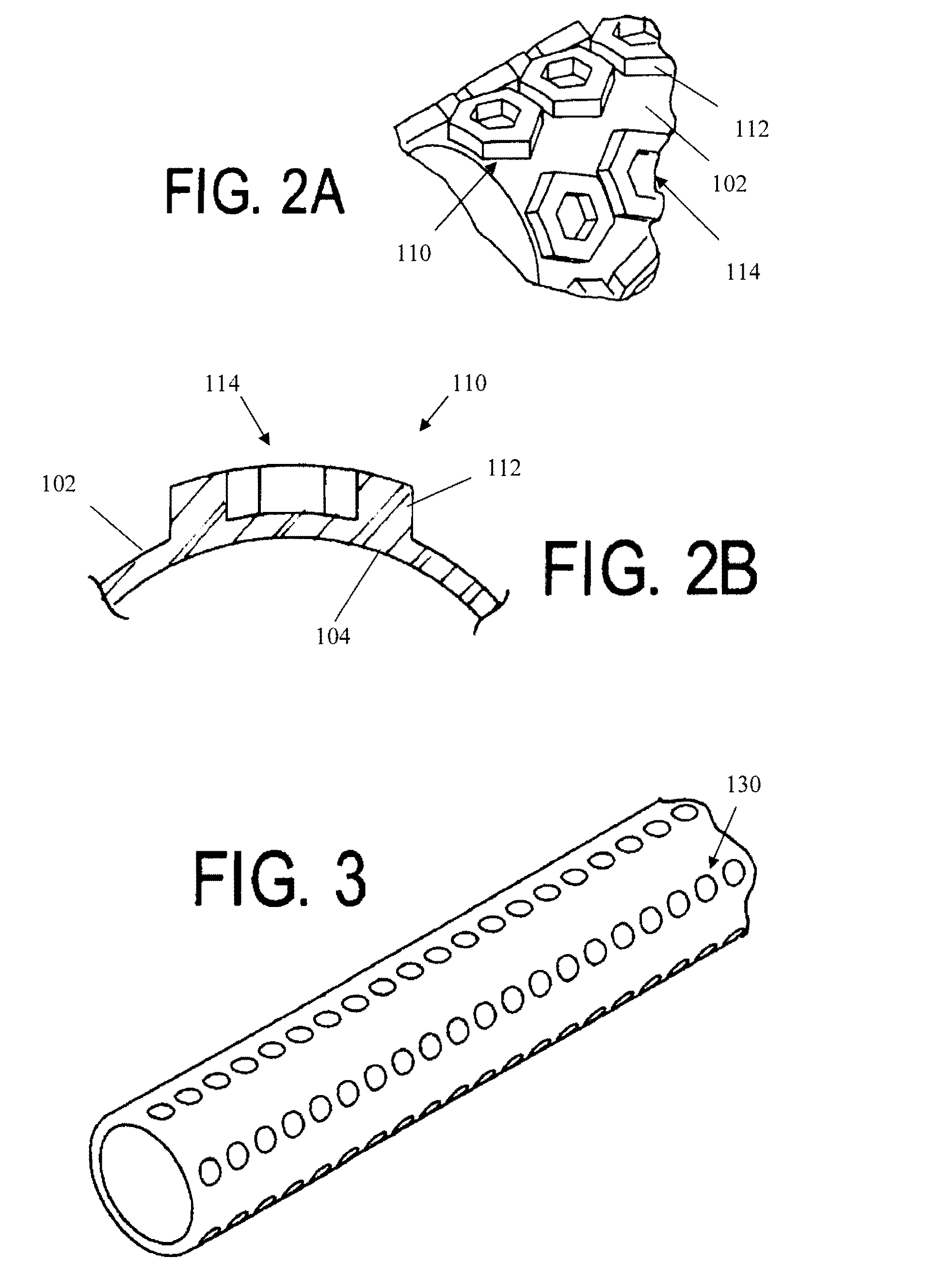 Ultrasound visible catheter