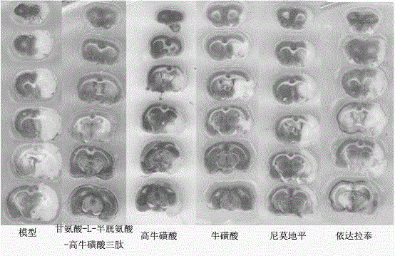 Glycine-L-cysteine-homotaurine tripeptide and application thereof