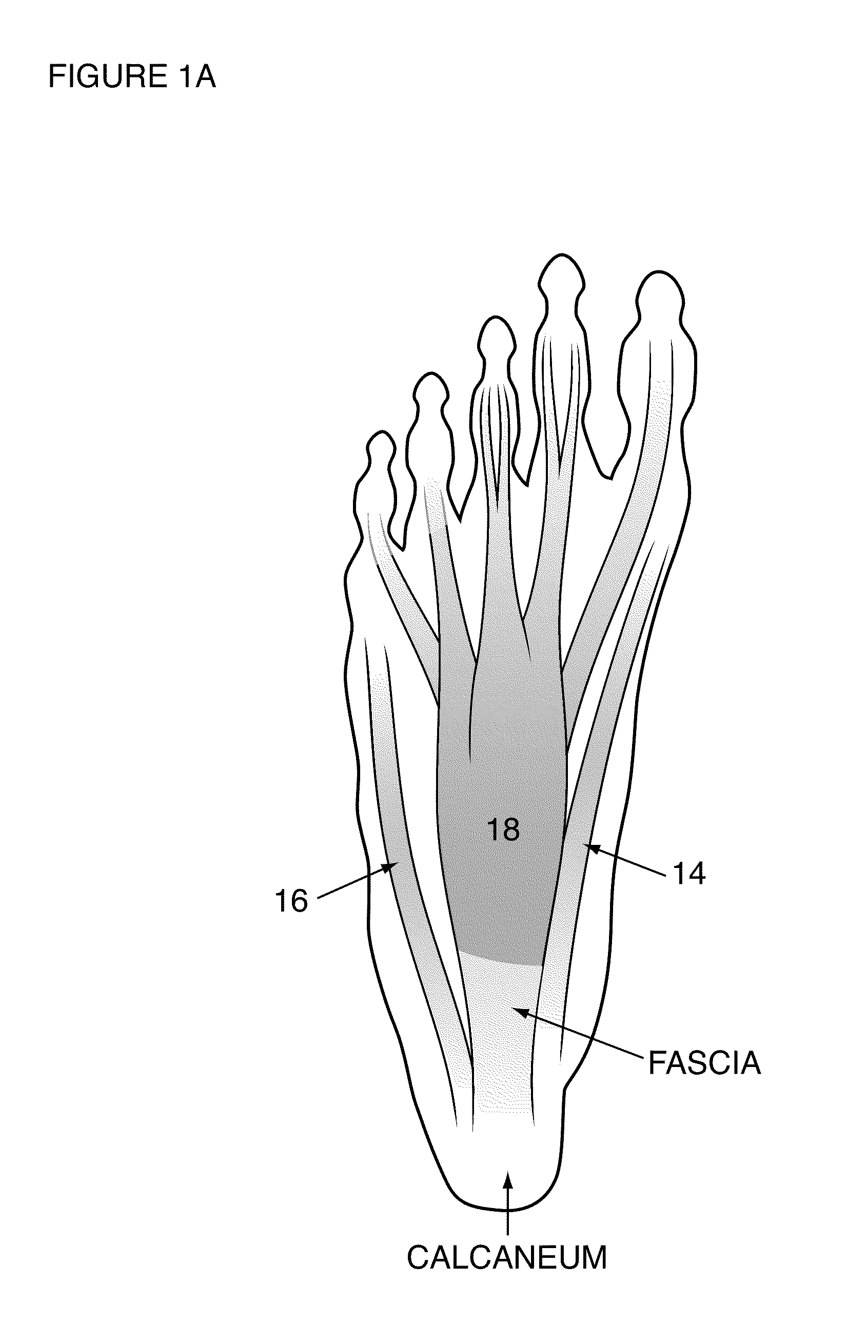 Programmable electrical stimulation of the foot muscles