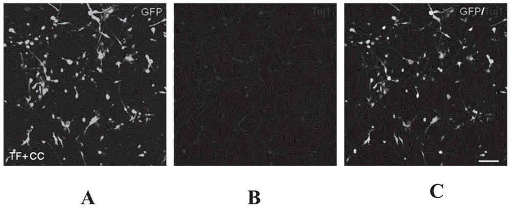 Method for inducing fibroblasts into neuronal cells by transdifferentiation and application of fibroblasts